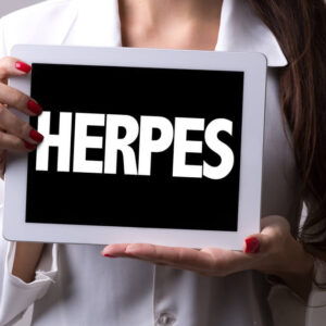 Genital Herpes
