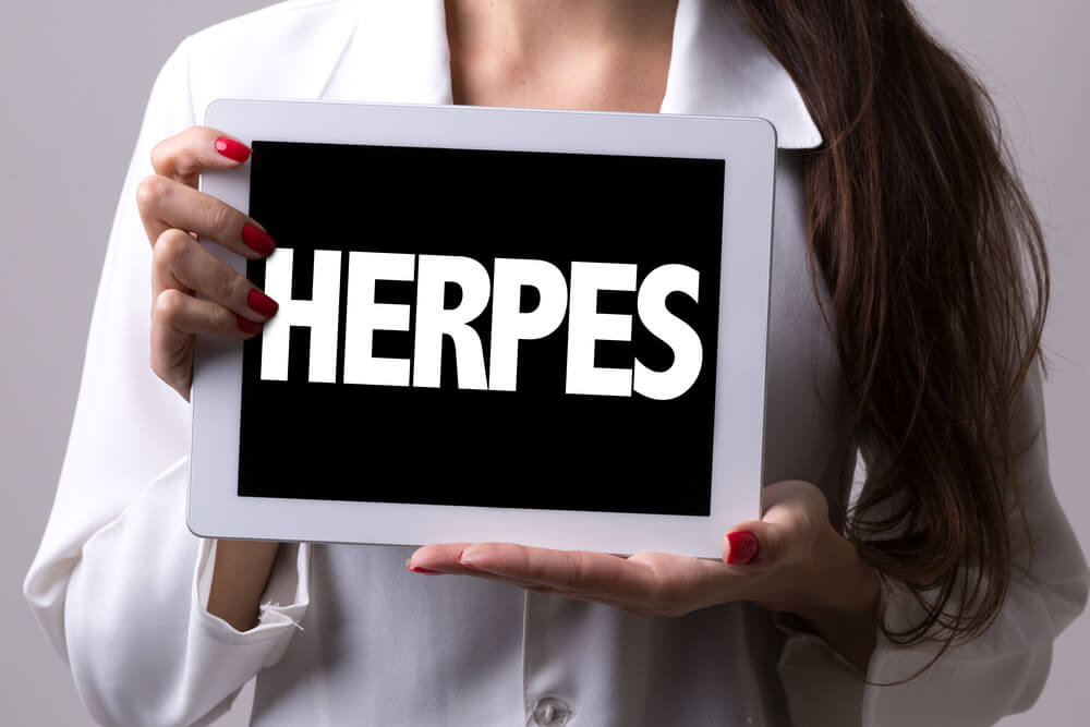 Genital Herpes